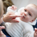 treat tongue tie in babies